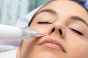 Best Actinic Keratoses Removal 3 Actinic keratoses Taunton solutions - book in today!