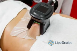 Does Fat Freezing At Home Work? 3 Fat freezing at home from Lipo Sculpt Taunton